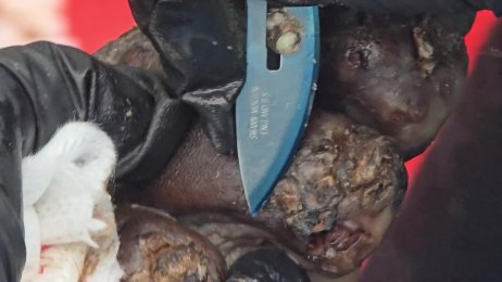Henry Mukuna (75) dejiggering #2 - rotting bugs, pus & in so much pain (June 3rd 2025)