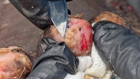 Isaac Oputi’s very first jigger digging #3 - (June 9th 2025)