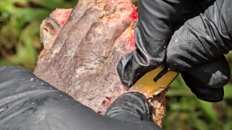 Jepheneah Pome’s jigger removal process - (June 11th 2025)