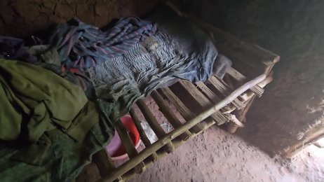 Robert Bulimo’s follow up jigger digging - the jigger house (June 21st 2025)