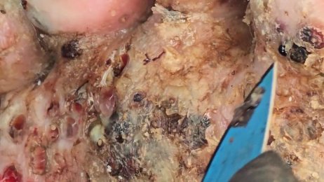 Robert Bulimo’s follow up dejiggering - A LOT OF JIGGERS #2 (June 21st 2025)