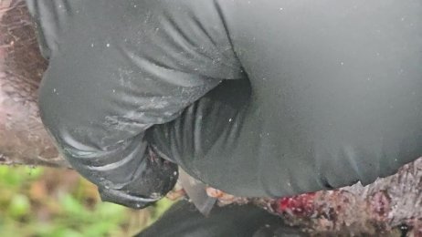 Elkana Opati jigger digging #3 - many visible bugs taken out whole (June 26th 2025)