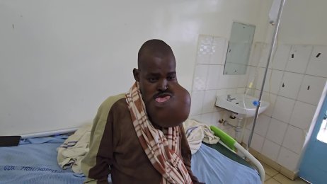 Meshack Oliech’s Update - one and half months in hospital (July 17th 2025).